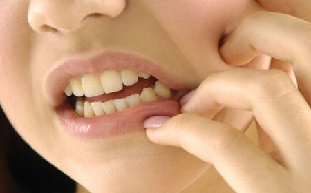 EBV, Öpücük hastalığı nedir? Belirtileri ve tedavi yöntemleri nelerdir?