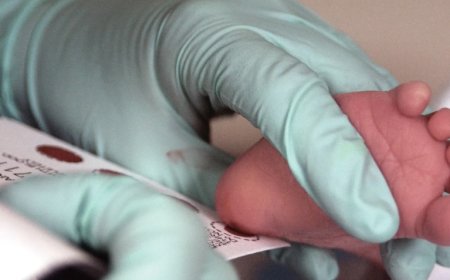 Ulusal Fenilketonüri Günü